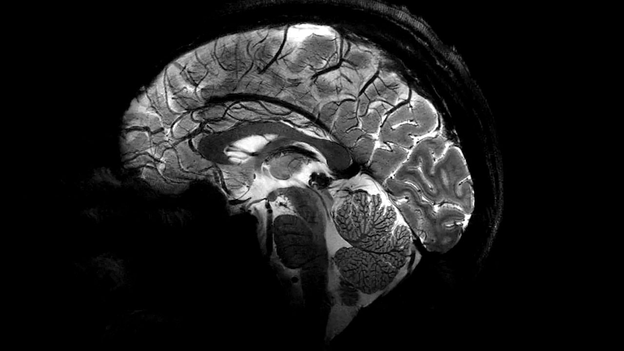 Dünyanın En Güçlü MRI Makinesi ile Alınan İlk Beyin Taramaları